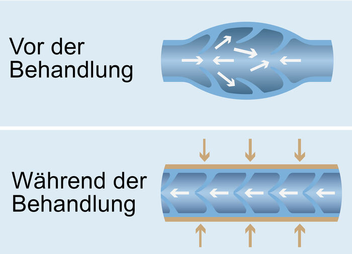 Venen-Massageger&auml;t 