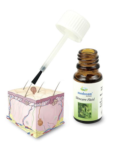 Skincare-Fluid gegen Stiel- oder Alterswarzen 