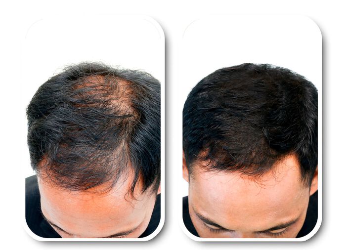 Velform&reg; Nutritional Lotion f&uuml;r jeden Haartyp 