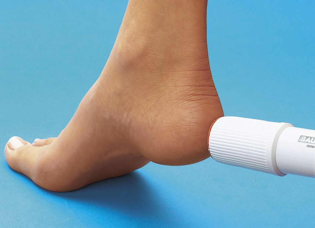 Natury Nails Basisbohrer 20 Mm Für Pediküre-Scheiben – Mit 4 Schlitzen, Für Hornhautentfernung An Drehmaschinen