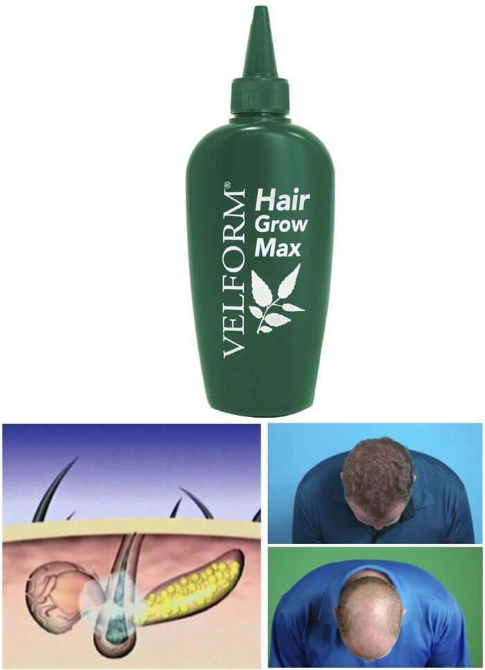 &laquo;VELFORM Hair Grow Max&raquo; Haarwasser 