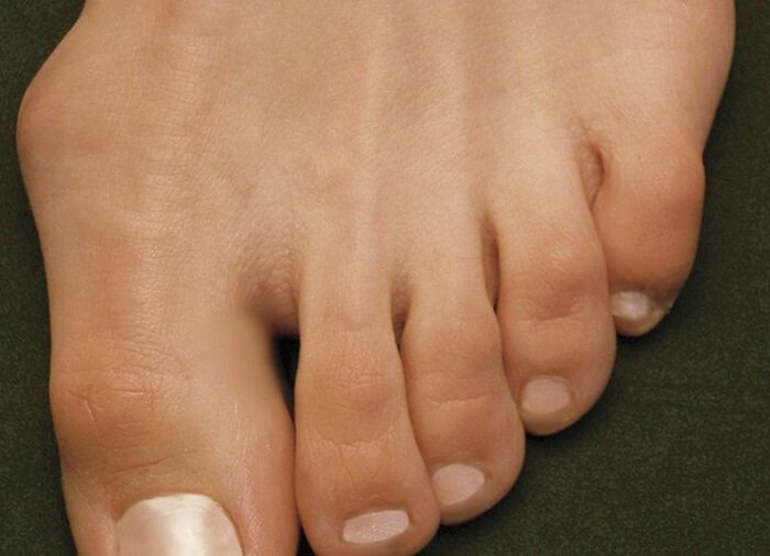 Damen Klett-Halbschuh im Blüten-Design 